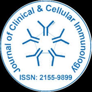 Indoleamine 2,3-Dioxygenase (IDO); Silenced Dendritic Cell Vaccine with Ipilimumab in Treating Metastatic Melanoma Patients: A Case Report